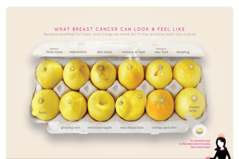 Breast Cancer Screening by Mammogram